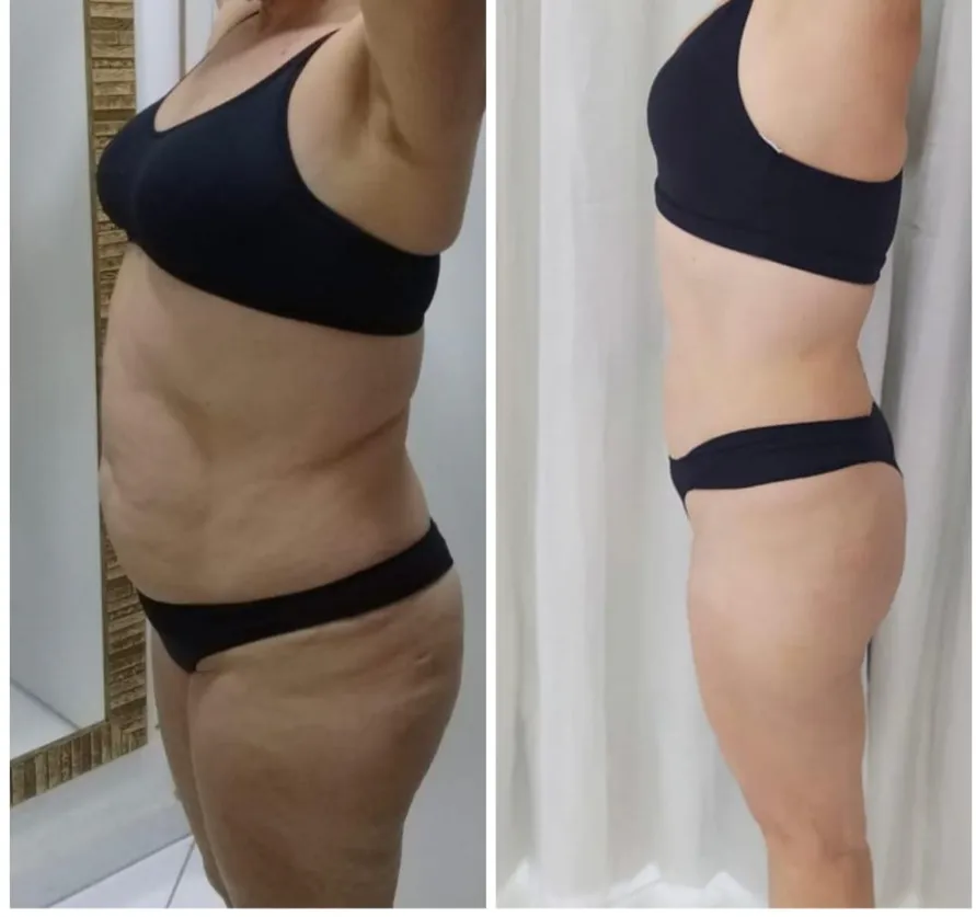 WhatsApp Image 2025-07-01 at 12.41.14